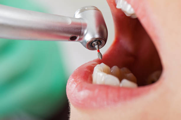 Best Weekend Emergency Dentist in Converse, TX